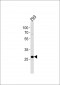 PRB4 Antibody (Center)
